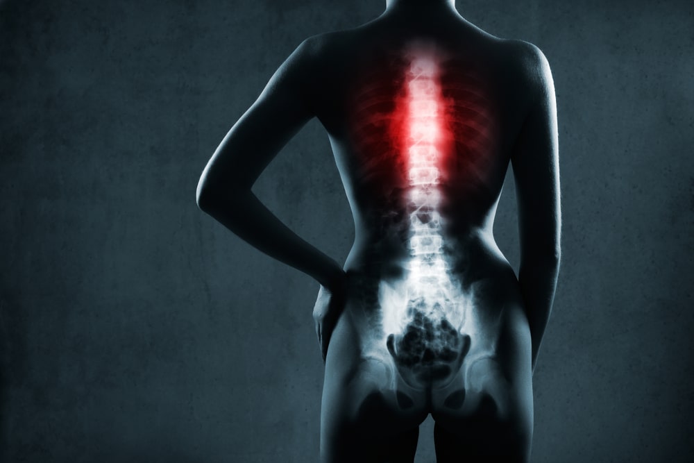 motorcycle accident lawyer
